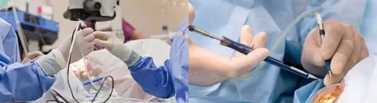 Surgery to restore sight